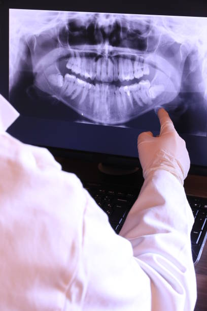 Best Emergency Dentist for Lost Fillings or Crowns in Vails Gate, NY